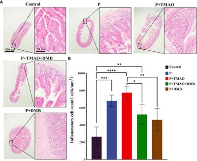 Gut microbiota-dependent trimethylamine n-oxide pathway contributes to the bidirectional relationship between intestinal inflammation and periodontitis